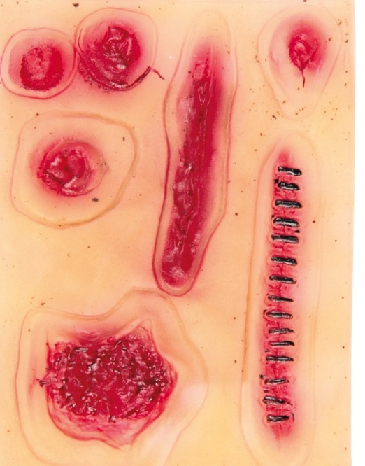 Cicatrices Latex